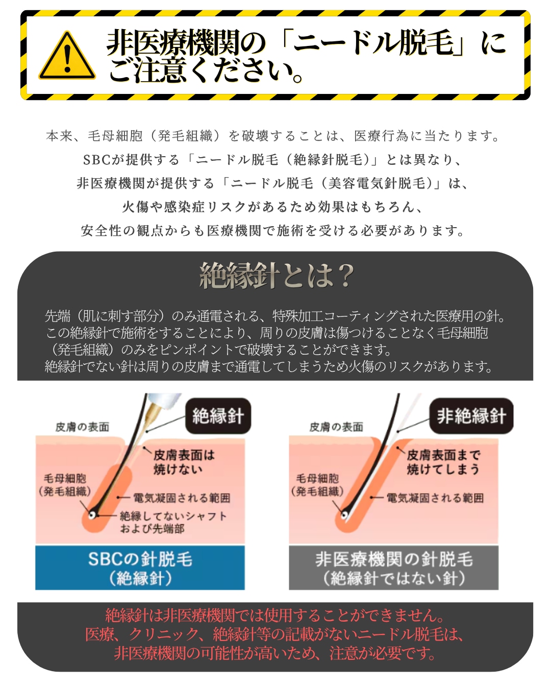 非医療脱毛との違い